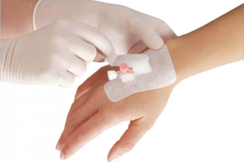 Пленочная фиксирующая повязка для катетера Пленочная фиксирующая повязка для катетера